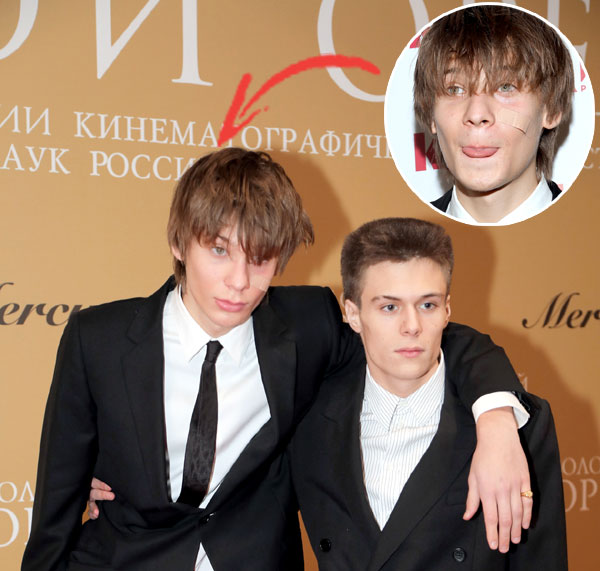 Петя и его дядя Андрюша выглядели странно