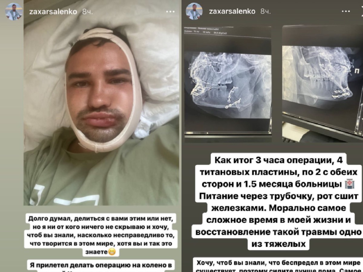«Захар