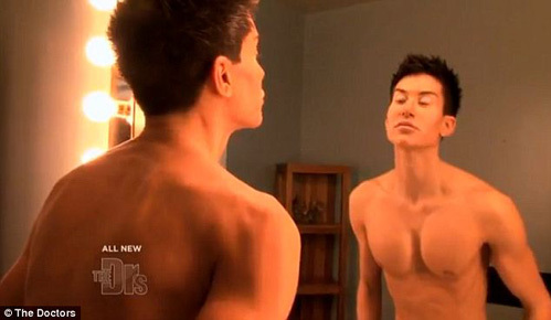 Мускулы парень нарастил не в спортзале, а на столе хирурга