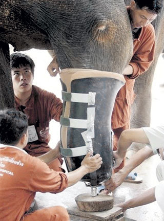 Примерка протеза